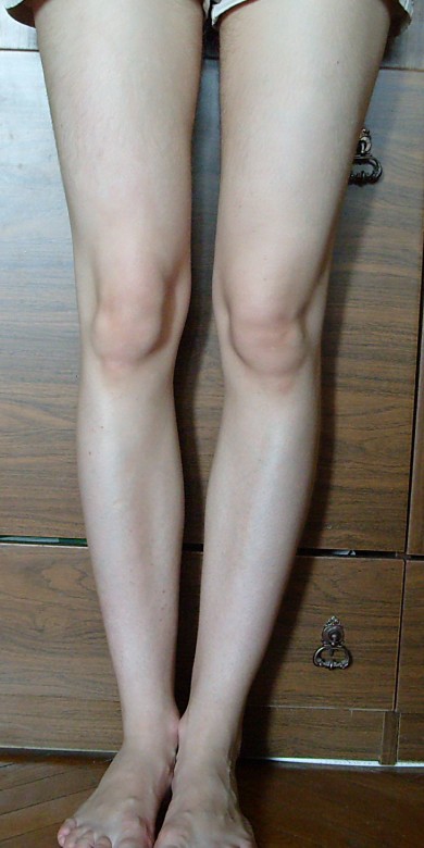Кривые ноги (№2)