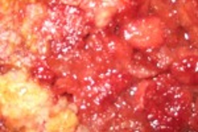 Превосходный клубничный пирог! - приготовление