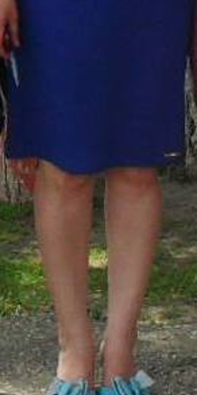 помогите с кривыми ногами